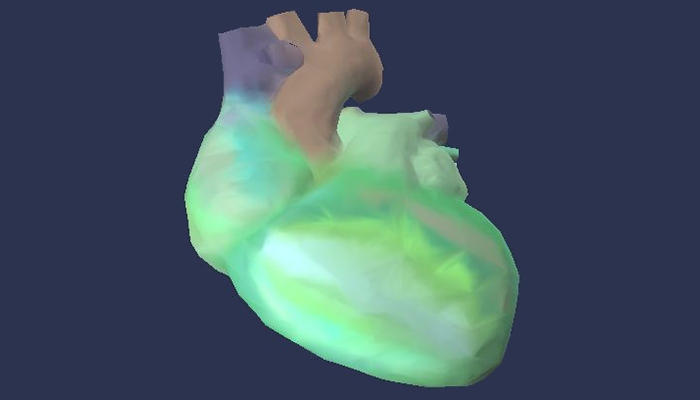 Діагностика серця кардіовізором - 