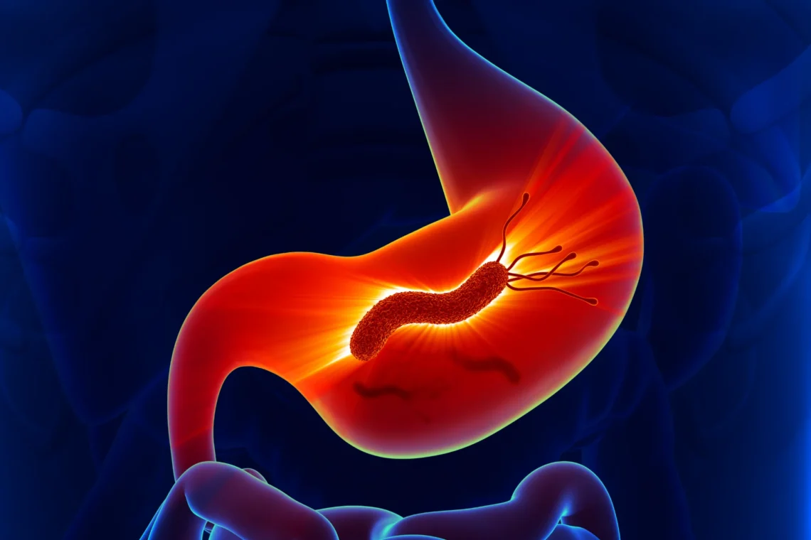 Визначення Helicobacter pylori при ВГДС